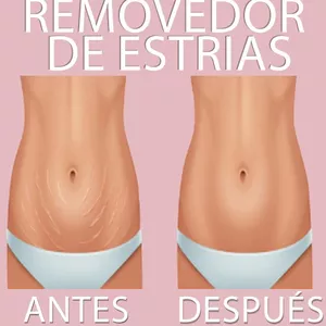 Imagen de portada para Curso online Removedor de estrias
