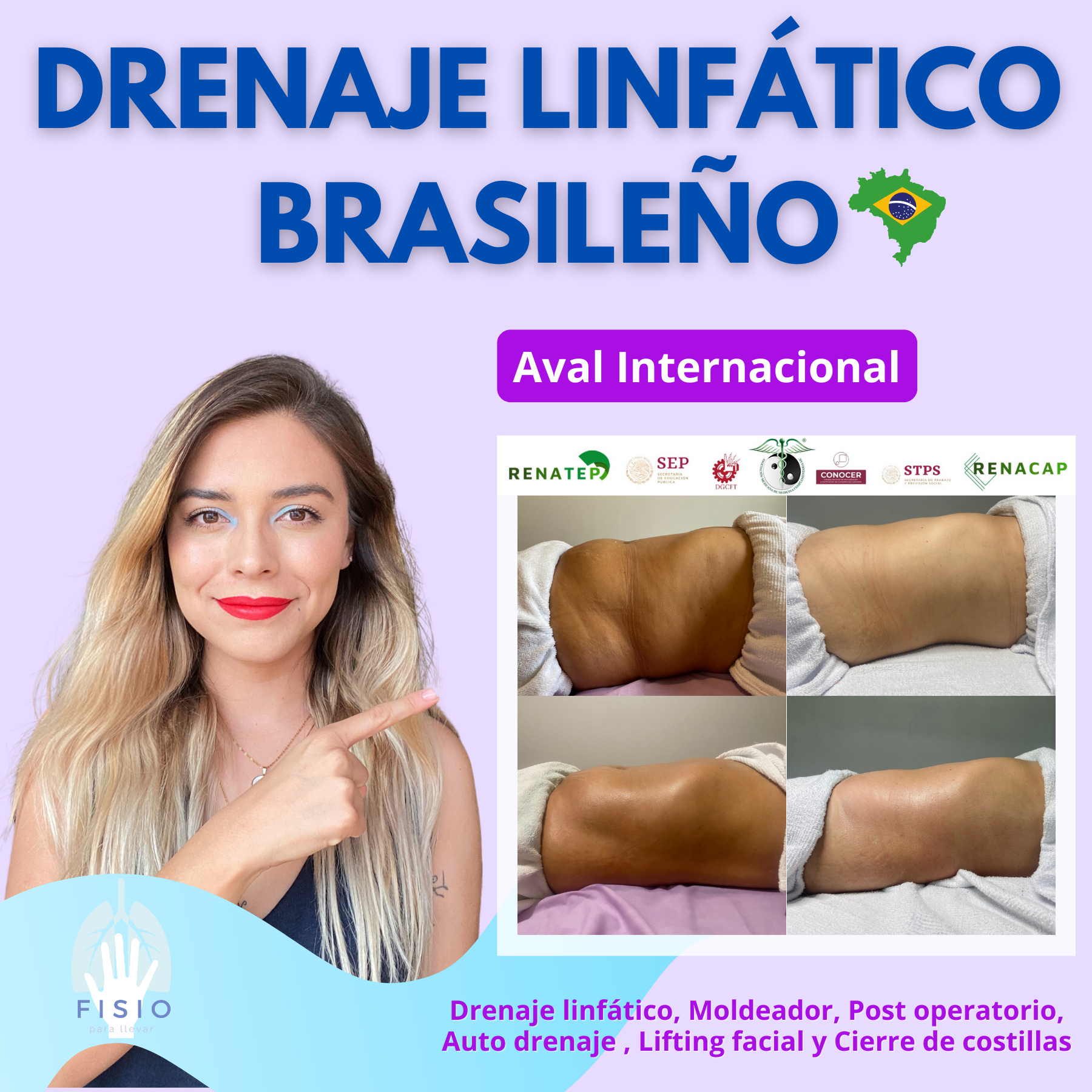 DRENAJE LINFÁTICO BRASILEÑO