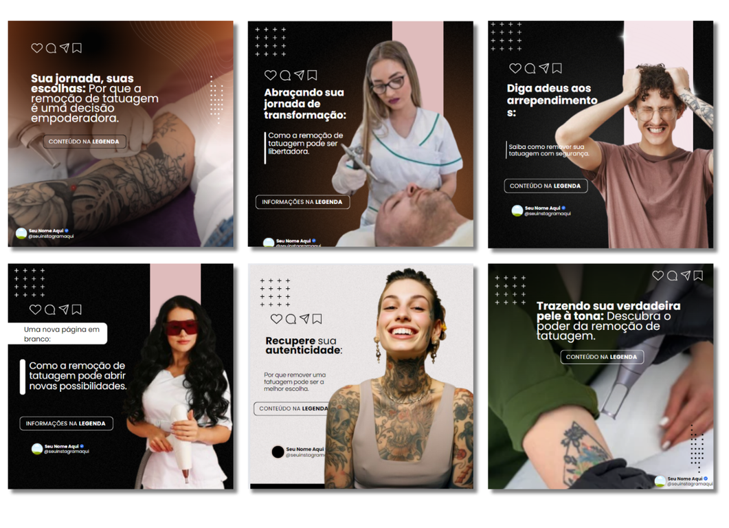 Imagem do curso Pack Remoção de Tatuagem