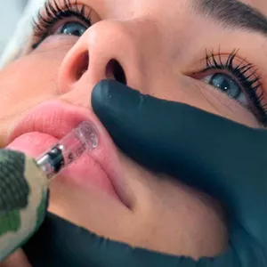 Imagen de portada para Curso online Aumento de labios con Hyaluronic Pen