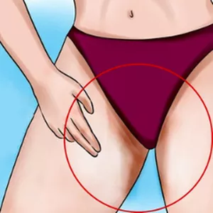 Imagem de capa para o Curso online Tratamentos para Remover Manchas Escuras na Pós-Depilação