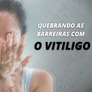 Imagem de capa para o Ebook Quebrando as Barreiras com o Vitiligo 