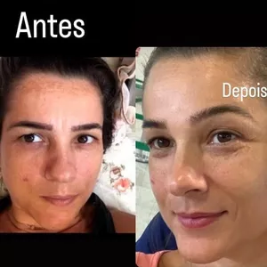 Imagem de capa para o Curso online APRENDA A TIRAR MANCHAS DO SEU ROSTO EM MENOS DE 15 DIAS!! 