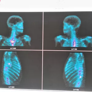 Imagen de portada para Ebook Centellograma óseo