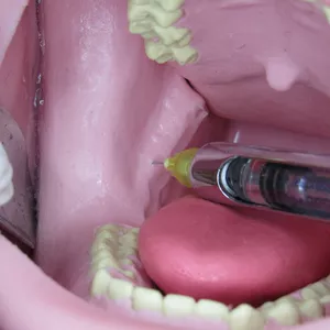 Imagem de capa para o Curso online Anestesia Odontológica Prática - SOS OdontoCursos