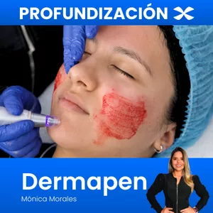 Imagen de portada para Curso online Manejo de inesteticismos con Dermapen