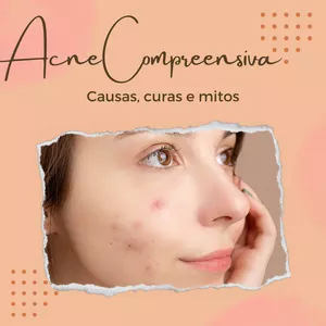 Imagem de capa para o Ebook Acne Compreensiva Causas Curas e Mitos