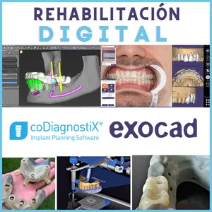 Imagen de portada para Curso online REHABILITACIÓN DIGITAL DENTAL - PROGRAMAS CODIAGNOSTIX Y EXOCAD