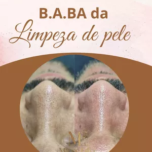 Imagem de capa para o Curso online B.A.BA DA LIMPEZA DE PELE