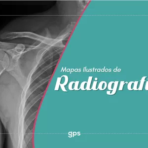 Imagem de capa para o Ebook PT Mapas ilustrados de Radiografia