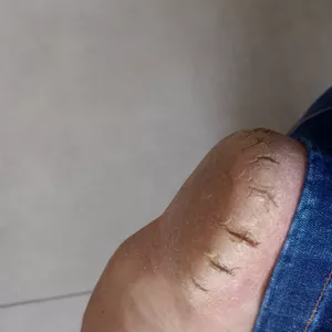 Imagem de capa para o Curso online Plastica é spa dos pés 