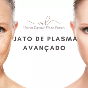 Curso Jato de Plasma Avançado