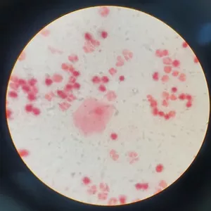 Imagen de portada para Curso online Infecciones genitales