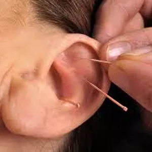 Curso curso de auriculoterapia