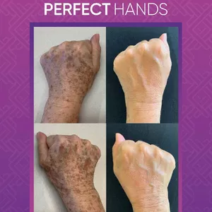 Imagem do curso PERFECT HANDS