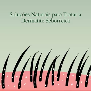 Imagem de capa para o Ebook Soluções Naturais para tratar a dermatite seborreica