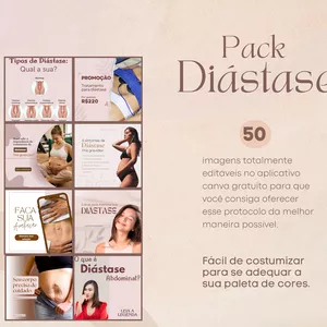 Imagem de capa para o Curso online Pack Diástase