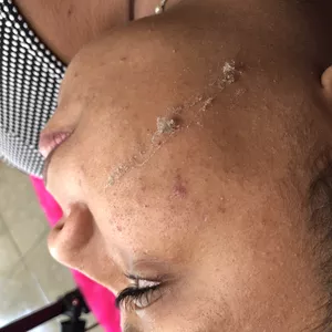 Imagem de capa para o Curso online Dermaplaning 