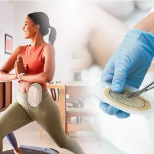 Imagem de capa para o Curso online Curso Aprimoramento em Estomia