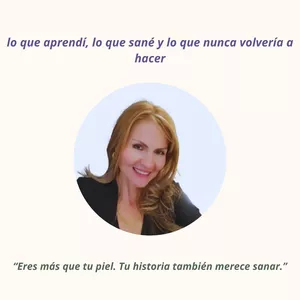 Imagen de portada para Ebook Mi vida con rosácea: lo que aprendí, lo que sané y lo que nunca volvería a hacer