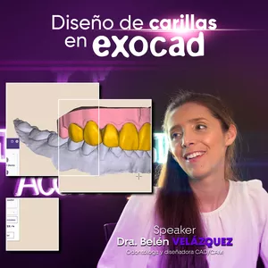 Imagen de portada para Curso online Carillas en EXOCAD0