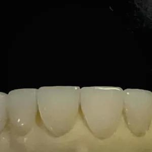 Imagen de portada para Curso online Exocad