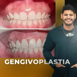Imagem de capa para o Curso online Gengivoplastia Avançada