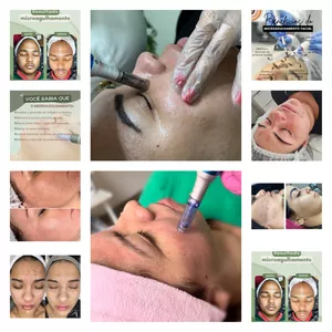 Imagem de capa para o Curso online Microagulhamento Facial   /  Hydra Gloss