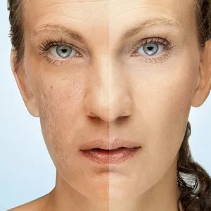 Curso de Máscara Clareadora TurboUP