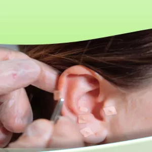 Imagem de capa para o Ebook Auriculoterapia Fácil: Domine a Técnica e Transforme Vidas