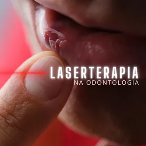 Imagem de capa para o Ebook Laserterapia na odontologia