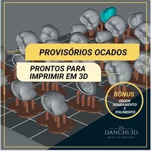 Imagem de capa para o Curso online "STL" Provisórios Ocados Posteriores - Prontos para Imprimir + E-Book Acabamento e Polimento
