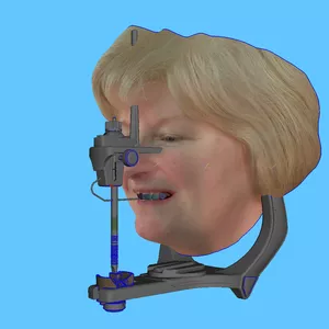 impressão 3d Odontologia Digital com programa grátis - Meshmixer >