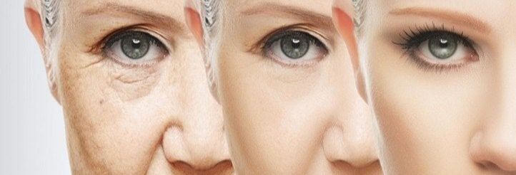 APRENDE MICROPUNTURA EN MANCHAS CON SUELY SOARES