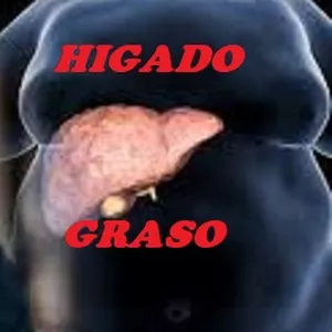 Imagem principal do produto GUIA  PASO A PASO  LIMPIEZA DEL HIGADO Y VESICULA 