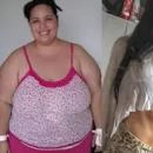 Imagem de capa para o Curso online TUDO SOBRE BARIÁTRICA PELO O SUS 