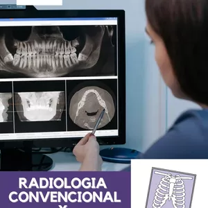 Imagem de capa para o Ebook Desafios da Radiologia Convencional x Radiologia Digital