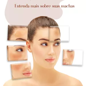 Imagem de capa para o Ebook Melasma