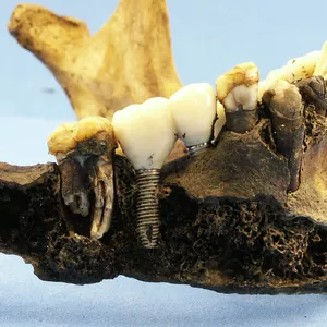 Imagem de capa para o Ebook Curso de Odontologia Legal para Concursos de Odontolegista (pdf)