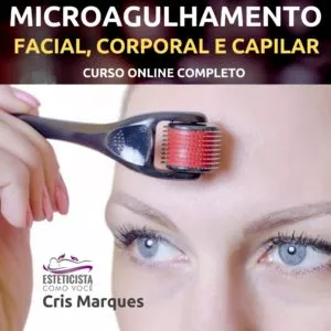 Imagem de capa para o Curso online Microagulhamento sem Mistérios