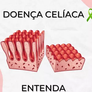 Imagem de capa para o Ebook E-BOOK DOENÇA CELÍACA