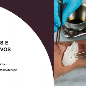 Imagem de capa para o Curso online Feridas e Curativos 2.0