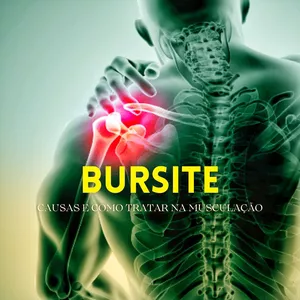 Imagem de capa para o Ebook Guia Completo para Tratar Bursite no ombro dentro da Musculação