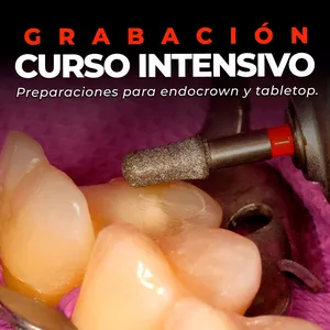 Imagen de portada para Curso online GRABACIÓN CURSO EN FORMATO DE CLASES - INTENSIVO PREPARACIONES ENDOCROWN Y TABLETOP