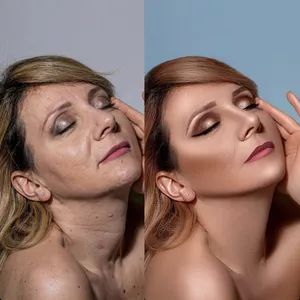 Imagem de capa para o Curso online Tratamento de pele intensivo - PHOTOSHOP