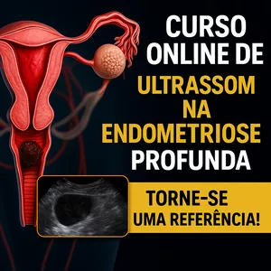 CURSO DE ULTRASSOM NA PESQUISA DE ENDOMETRIOSE