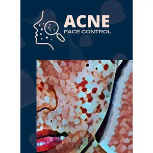 Imagen de portada para Ebook Método Acne Face Control