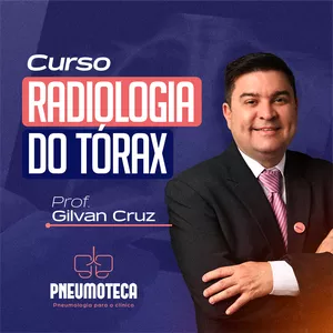 Imagem de capa para o Curso online Curso Radiologia do Tórax
