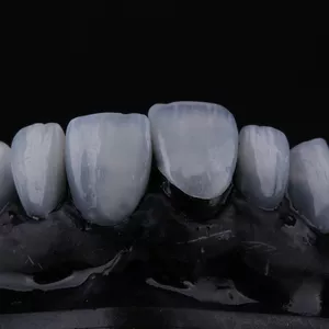 Imagem de capa para o Curso online Curso de Facetas de Resinas Indiretas