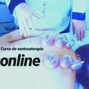 Curso Curso de Ventosaterapia  Chinesa: uma nova oportunidade profissional!